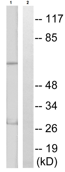 Western blot - Anti-S6K1 (phospho T389 + T412) antibody (AB60948), expandable thumbnail