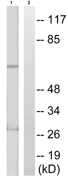 Western blot - Anti-S6K1 (phospho T389 + T412) antibody (AB60948)