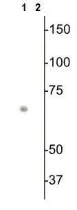 Western blot - Anti-S6K1 (phospho T398) antibody (AB228513)