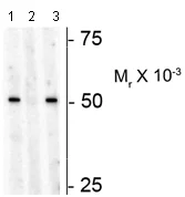 Western blot - Anti-S6K1 (phospho T449) antibody (AB207399)