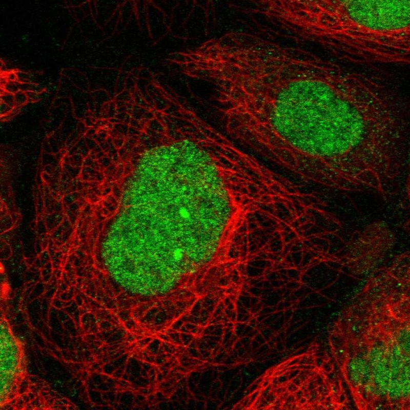 Immunocytochemistry/ Immunofluorescence - Anti-SA1 antibody (AB246988), expandable thumbnail