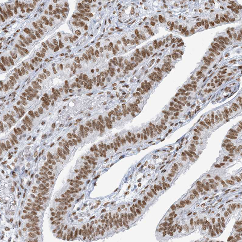 Immunohistochemistry (Formalin/PFA-fixed paraffin-embedded sections) - Anti-SA1 antibody (AB246988), expandable thumbnail