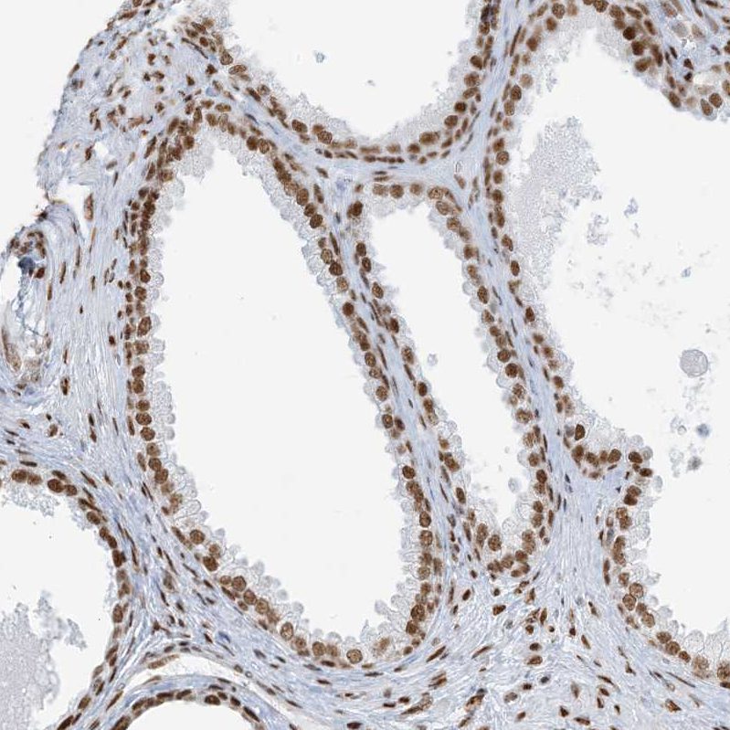 Immunohistochemistry (Formalin/PFA-fixed paraffin-embedded sections) - Anti-SA1 antibody (AB246988), expandable thumbnail