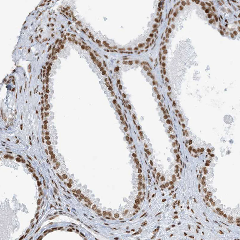 Immunohistochemistry (Formalin/PFA-fixed paraffin-embedded sections) - Anti-SA1 antibody (AB246988)