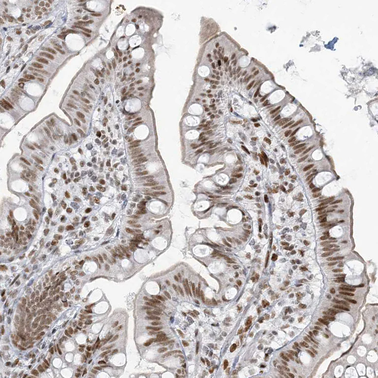 Immunohistochemistry (Formalin/PFA-fixed paraffin-embedded sections) - Anti-SA1 antibody (AB246988)