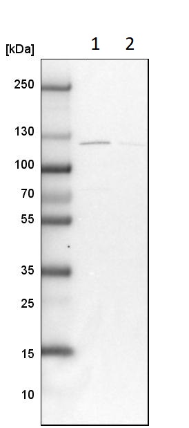 Western blot - Anti-SA1 antibody (ab246988), expandable thumbnail