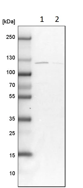Western blot - Anti-SA1 antibody (AB246988)