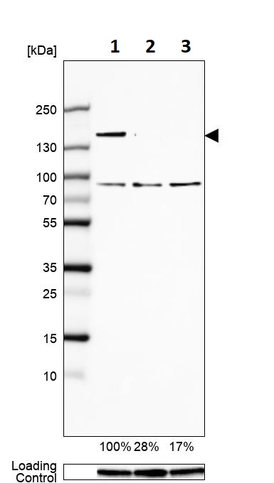 Western blot - Anti-SA1 antibody (AB246988), expandable thumbnail