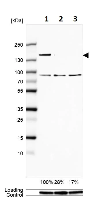 Western blot - Anti-SA1 antibody (AB246988)