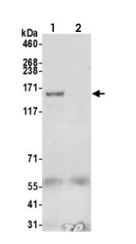 Immunoprecipitation - Anti-SA1 antibody (AB4455)