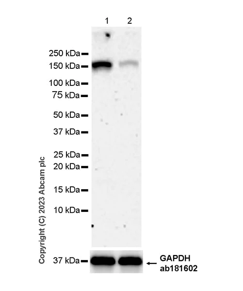 Western blot - Anti-SA1 antibody [EPR26227-76] (AB317301)