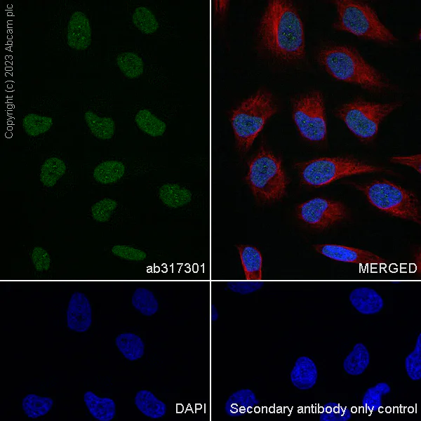 Immunocytochemistry/ Immunofluorescence - Anti-SA1 antibody [EPR26227-76] - BSA and Azide free (AB317302)