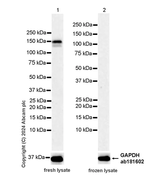 Western blot - Anti-SA1 antibody [EPR26227-76] - BSA and Azide free (AB317302)