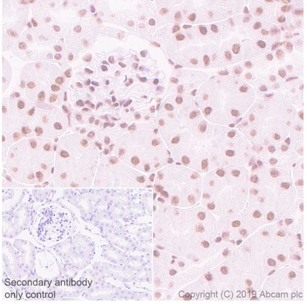 Immunohistochemistry (Formalin/PFA-fixed paraffin-embedded sections) - Anti-SA1 antibody [SUSI63B] (AB241544), expandable thumbnail