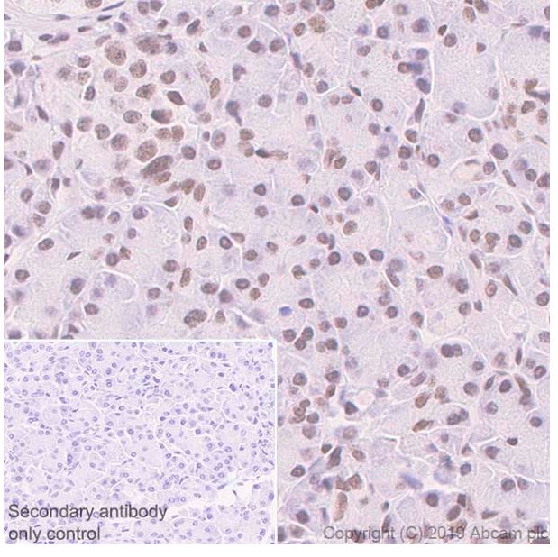 Immunohistochemistry (Formalin/PFA-fixed paraffin-embedded sections) - Anti-SA1 antibody [SUSI63B] (AB241544), expandable thumbnail