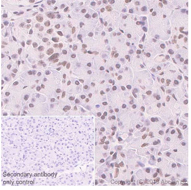 Immunohistochemistry (Formalin/PFA-fixed paraffin-embedded sections) - Anti-SA1 antibody [SUSI63B] (AB241544)