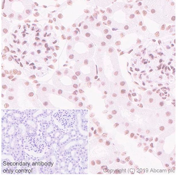 Immunohistochemistry (Formalin/PFA-fixed paraffin-embedded sections) - Anti-SA1 antibody [SUSI63B] (AB241544), expandable thumbnail