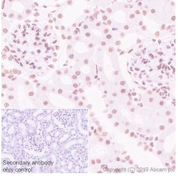 Immunohistochemistry (Formalin/PFA-fixed paraffin-embedded sections) - Anti-SA1 antibody [SUSI63B] (AB241544)
