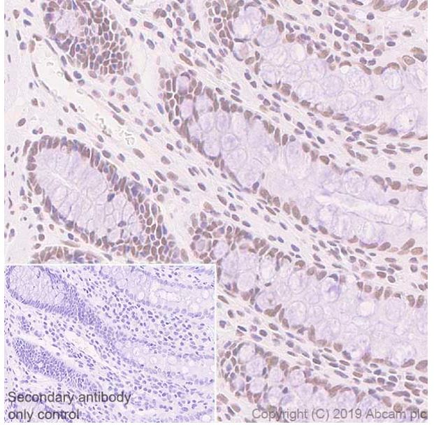 Immunohistochemistry (Formalin/PFA-fixed paraffin-embedded sections) - Anti-SA1 antibody [SUSI63B] (AB241544), expandable thumbnail
