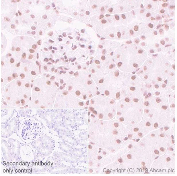 Immunohistochemistry (Formalin/PFA-fixed paraffin-embedded sections) - Anti-SA1 antibody [SUSI63B] - BSA and Azide free (AB252782)