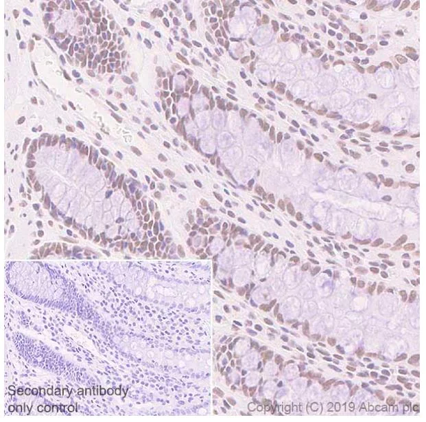 Immunohistochemistry (Formalin/PFA-fixed paraffin-embedded sections) - Anti-SA1 antibody [SUSI63B] - BSA and Azide free (AB252782)