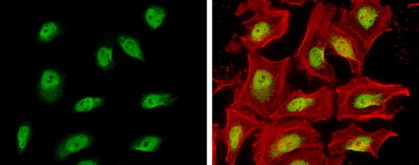 Immunocytochemistry/ Immunofluorescence - Anti-SA2 antibody - C-terminal (AB229609), expandable thumbnail