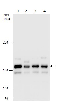 Western blot - Anti-SA2 antibody - C-terminal (AB229609), expandable thumbnail
