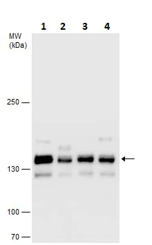Western blot - Anti-SA2 antibody - C-terminal (AB229609)
