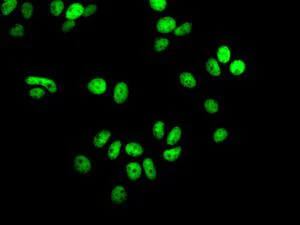 Immunocytochemistry/ Immunofluorescence - Anti-SA2 antibody [EPR10993] - BSA and Azide free (AB249682)