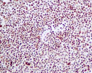 Immunohistochemistry (Formalin/PFA-fixed paraffin-embedded sections) - Anti-SA2 antibody [EPR10994(B)] (AB155081), expandable thumbnail