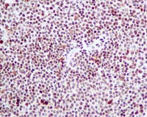 Immunohistochemistry (Formalin/PFA-fixed paraffin-embedded sections) - Anti-SA2 antibody [EPR10994(B)] (AB155081)