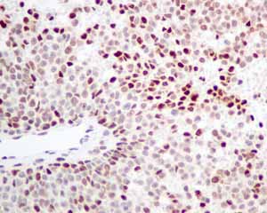 Immunohistochemistry (Formalin/PFA-fixed paraffin-embedded sections) - Anti-SA2 antibody [EPR10994(B)] (ab155081), expandable thumbnail
