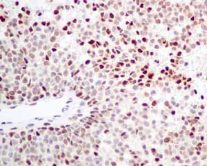 Immunohistochemistry (Formalin/PFA-fixed paraffin-embedded sections) - Anti-SA2 antibody [EPR10994(B)] (AB155081)