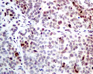 Immunohistochemistry (Formalin/PFA-fixed paraffin-embedded sections) - Anti-SA2 antibody [EPR10994(B)] (AB155081)