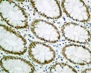 Immunohistochemistry (Formalin/PFA-fixed paraffin-embedded sections) - Anti-SA2 antibody [EPR10994(B)] (AB155081), expandable thumbnail