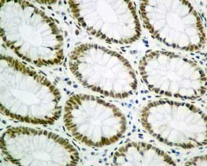 Immunohistochemistry (Formalin/PFA-fixed paraffin-embedded sections) - Anti-SA2 antibody [EPR10994(B)] (AB155081)
