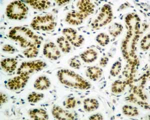 Immunohistochemistry (Formalin/PFA-fixed paraffin-embedded sections) - Anti-SA2 antibody [EPR10994(B)] (AB155081)