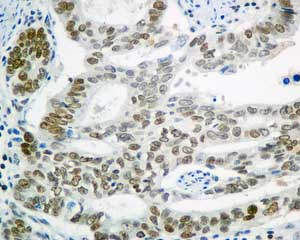 Immunohistochemistry (Formalin/PFA-fixed paraffin-embedded sections) - Anti-SA2 antibody [EPR10994(B)] (AB155081), expandable thumbnail