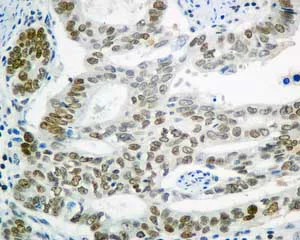Immunohistochemistry (Formalin/PFA-fixed paraffin-embedded sections) - Anti-SA2 antibody [EPR10994(B)] (AB155081)