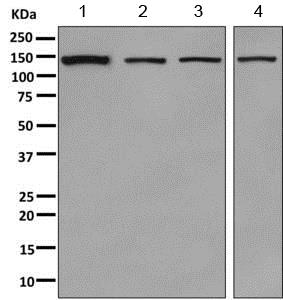 Western blot - Anti-SA2 antibody [EPR10994(B)] (AB155081), expandable thumbnail