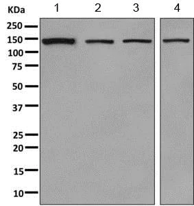 Western blot - Anti-SA2 antibody [EPR10994(B)] (AB155081)