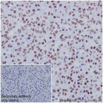 Immunohistochemistry (Formalin/PFA-fixed paraffin-embedded sections) - Anti-SA2 antibody [EPR17865] - C-terminal (AB201451)