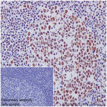 Immunohistochemistry (Formalin/PFA-fixed paraffin-embedded sections) - Anti-SA2 antibody [EPR17865] - C-terminal (AB201451)