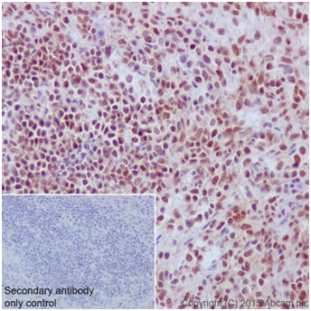 Immunohistochemistry (Formalin/PFA-fixed paraffin-embedded sections) - Anti-SA2 antibody [EPR17865] - C-terminal (ab201451), expandable thumbnail