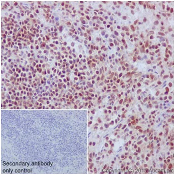 Immunohistochemistry (Formalin/PFA-fixed paraffin-embedded sections) - Anti-SA2 antibody [EPR17865] - C-terminal (AB201451)