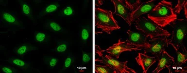Immunocytochemistry/ Immunofluorescence - Anti-SA2 antibody - N-terminal (AB229681)