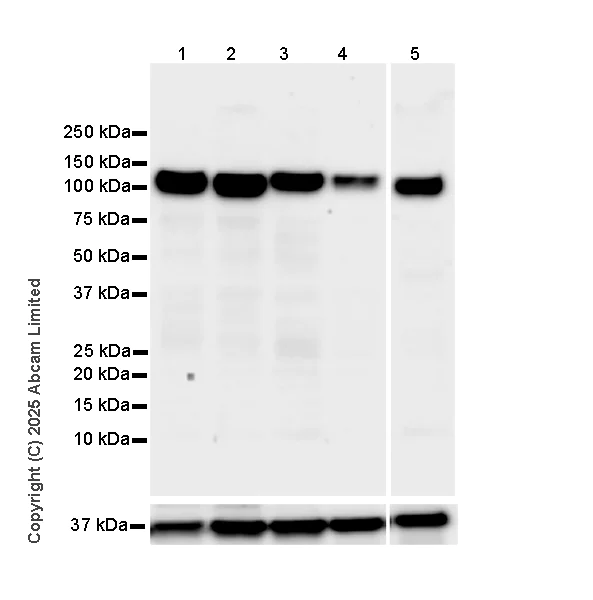 Western blot - Anti-SA2 (isoform-1) antibody [EPR30102-55] (AB324732)