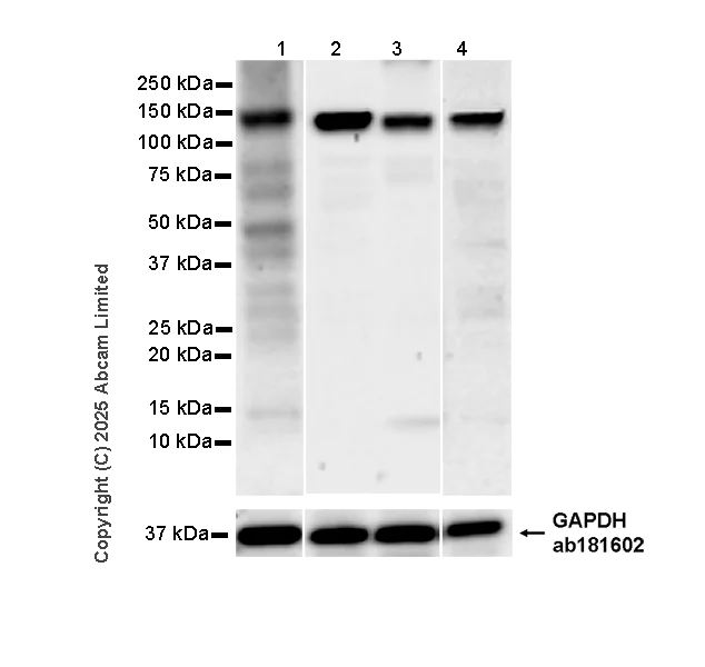 Western blot - Anti-SA2 (isoform-1) antibody [EPR30102-55] (AB324732)