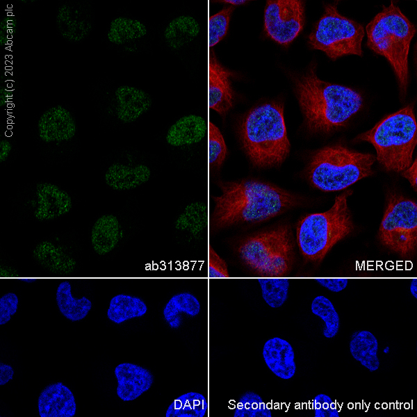 Immunocytochemistry/ Immunofluorescence - Anti-SA2 (isoform-2) antibody [EPR26892-61] (AB313877)