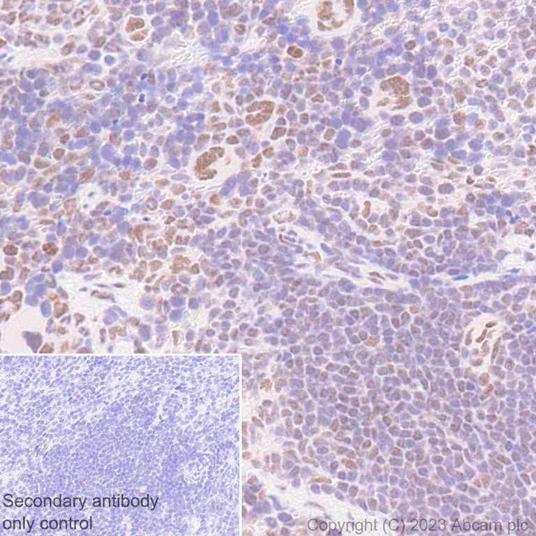 Immunohistochemistry (Formalin/PFA-fixed paraffin-embedded sections) - Anti-SA2 (isoform-2) antibody [EPR26892-61] - BSA and Azide free (AB313878)
